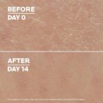 LA ROCHE POSAY LIPIKAR LAIT UREA 10% (4)