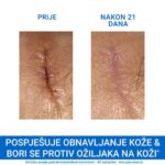 URIAGE BARIEDERM CICA krema s Cu Zn (3)