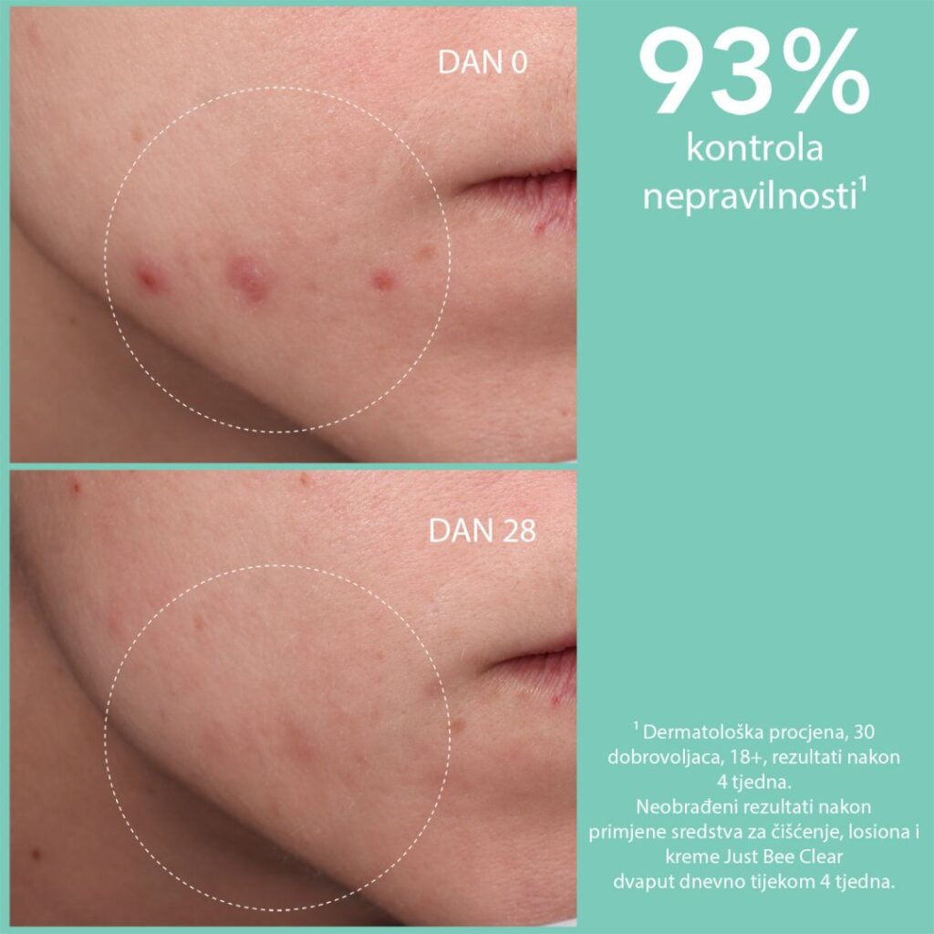 APIVITA JUST BEE CLEAR losion 200 ml (1)